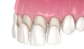 best dental clinic in Surat